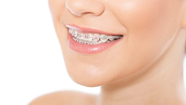 Ortodontista na Vila Carrão